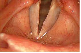 Разработка ГОЛОСОВЫХ СВЯЗОК Ма МЕ Ми Мо Му У У У .