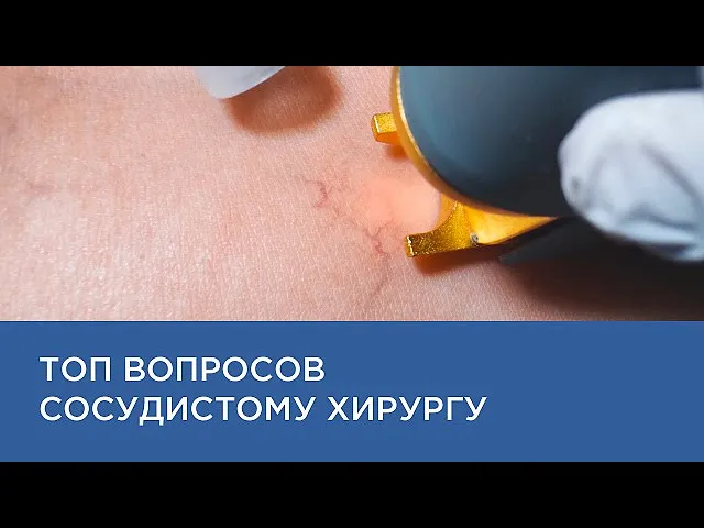ТОП ВОПРОСОВ ХИРУРГУ ПРО УДАЛЕНИЕ СОСУДИСТОЙ СЕТКИ