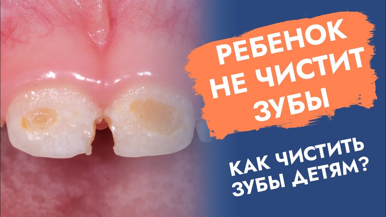 Ребенок не чистит зубы. Как чистить зубы детям?