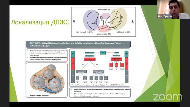 Пациент после лечения наджелудочковой тахикардии