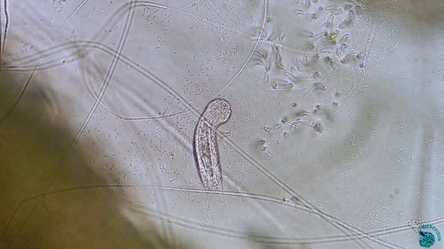 Брюхоресничные черви (Gastrotricha)