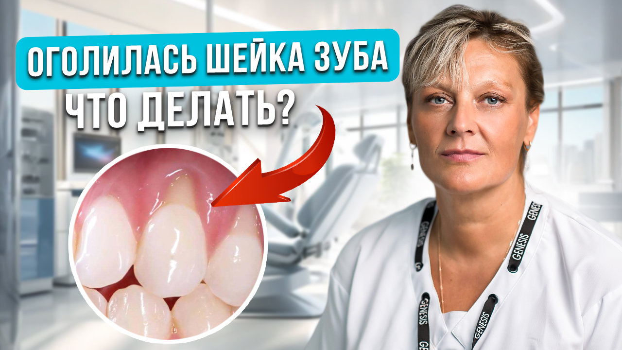 4 причины оголения шейки зуба. Что делать при рецессии дёсен? Методы лечения.