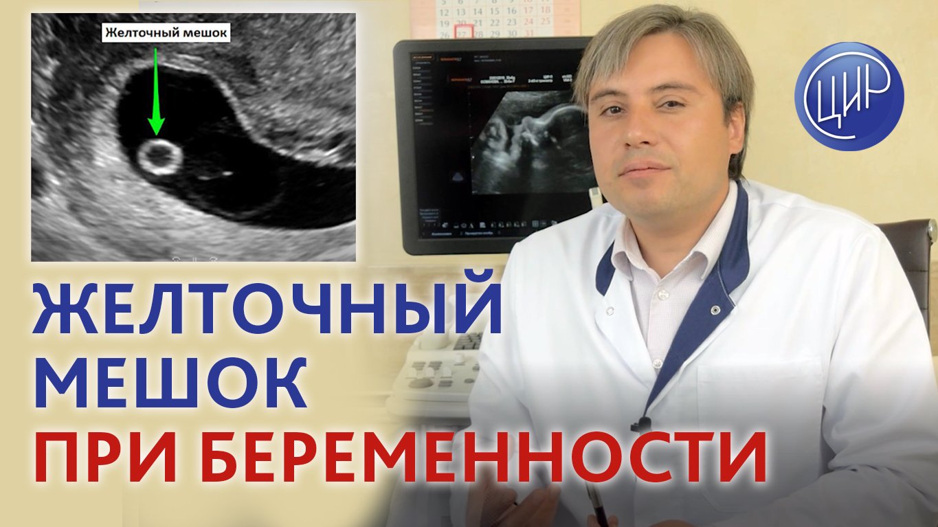 Что такое желточный мешок и зачем он нужен при беременности. Рассказал врач УЗД ЦИР Курганников А.С.
