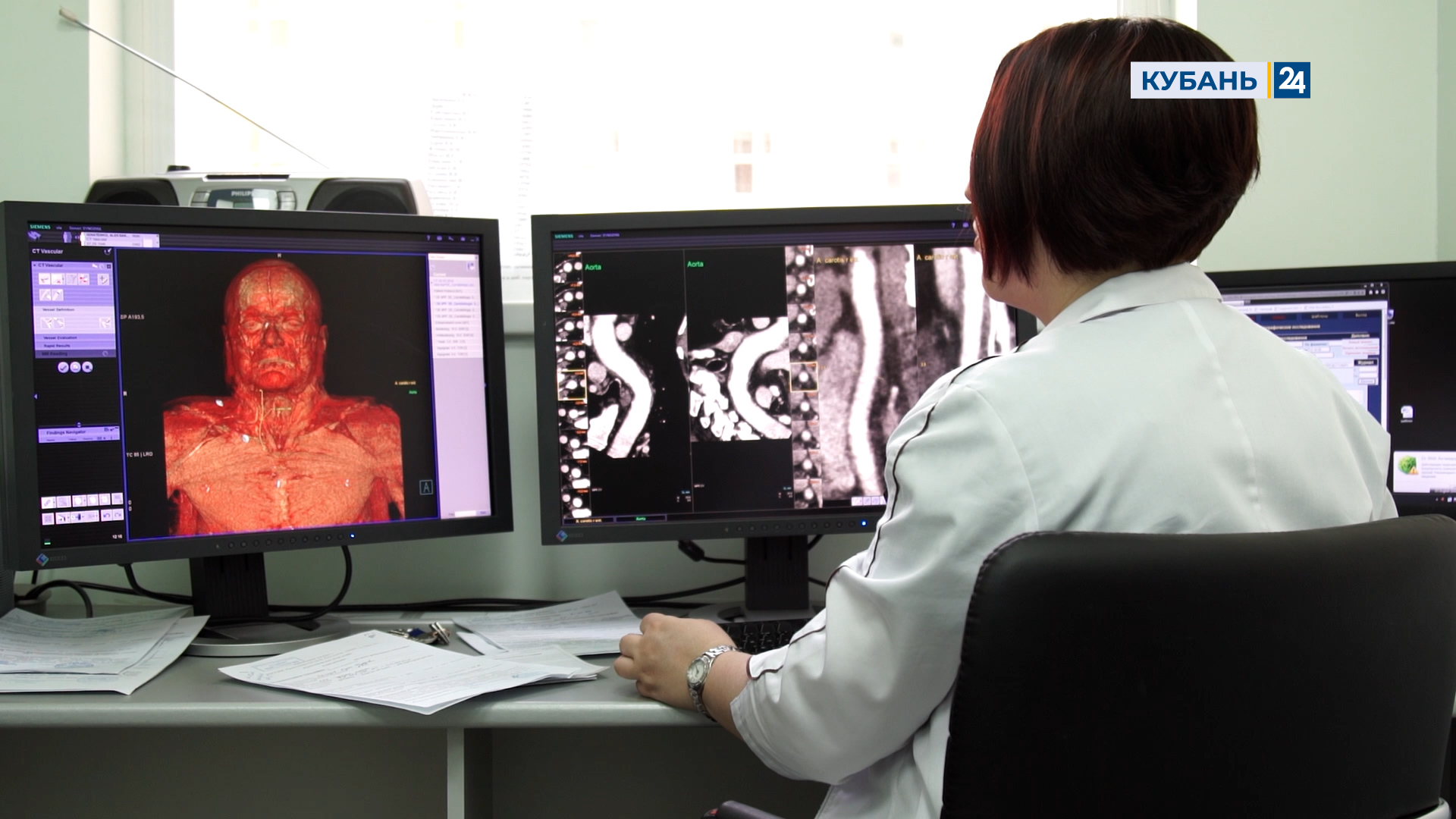 Деформирующий остеоартроз | История болезни 14.07.2022