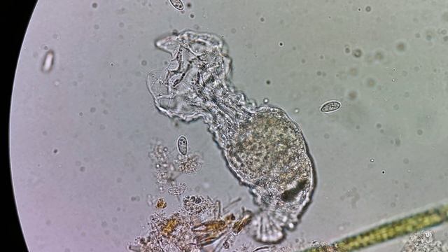 Коловратки (Rotifera)