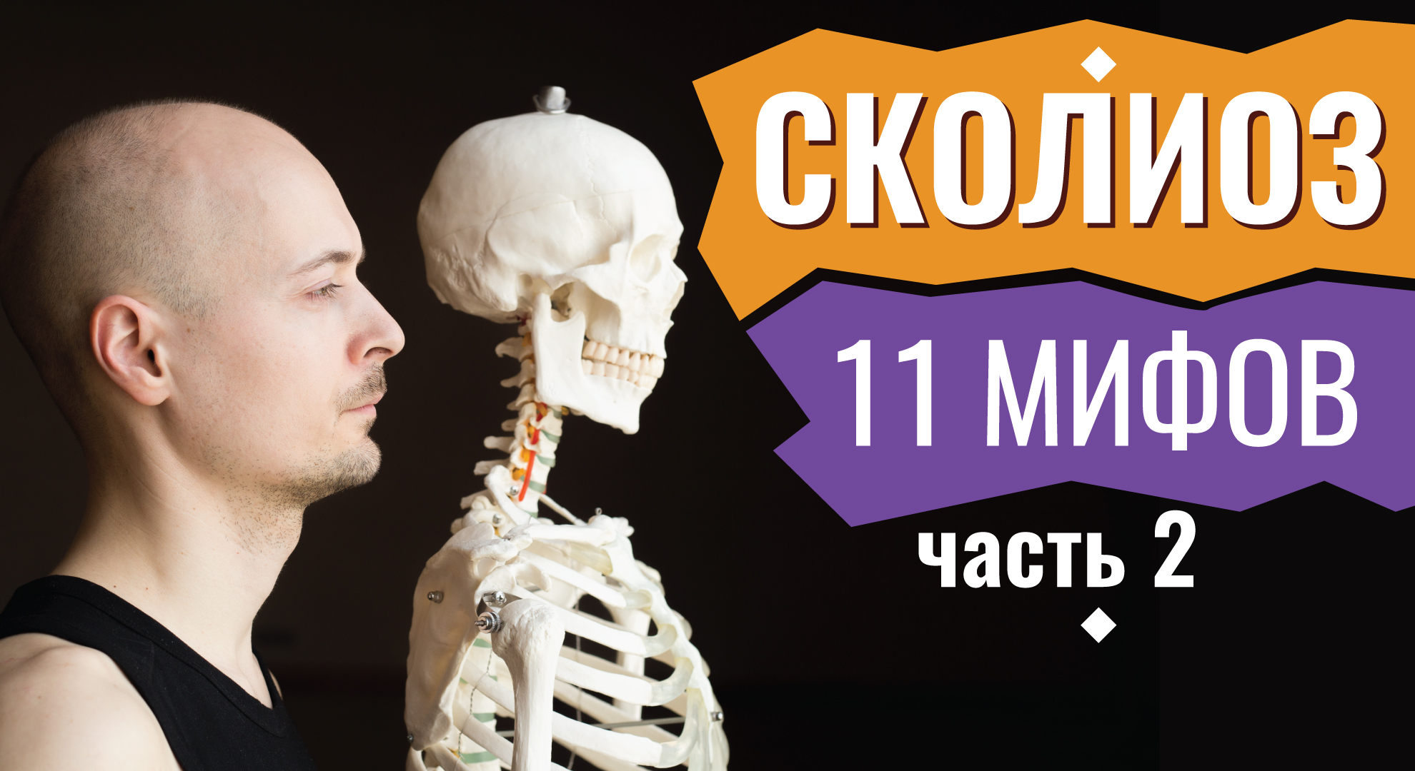 МИФЫ О СКОЛИОЗЕ. Часть 2. Определение, причины, лечение (упражнения, корсет).