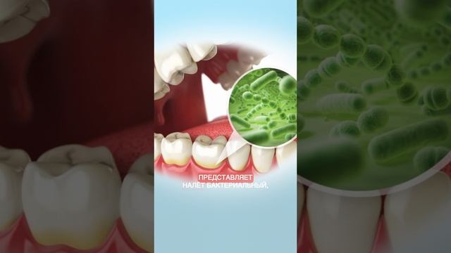 Как увидеть налёт на зубах? ТЕСТ на проверку, есть ли у вас налёт