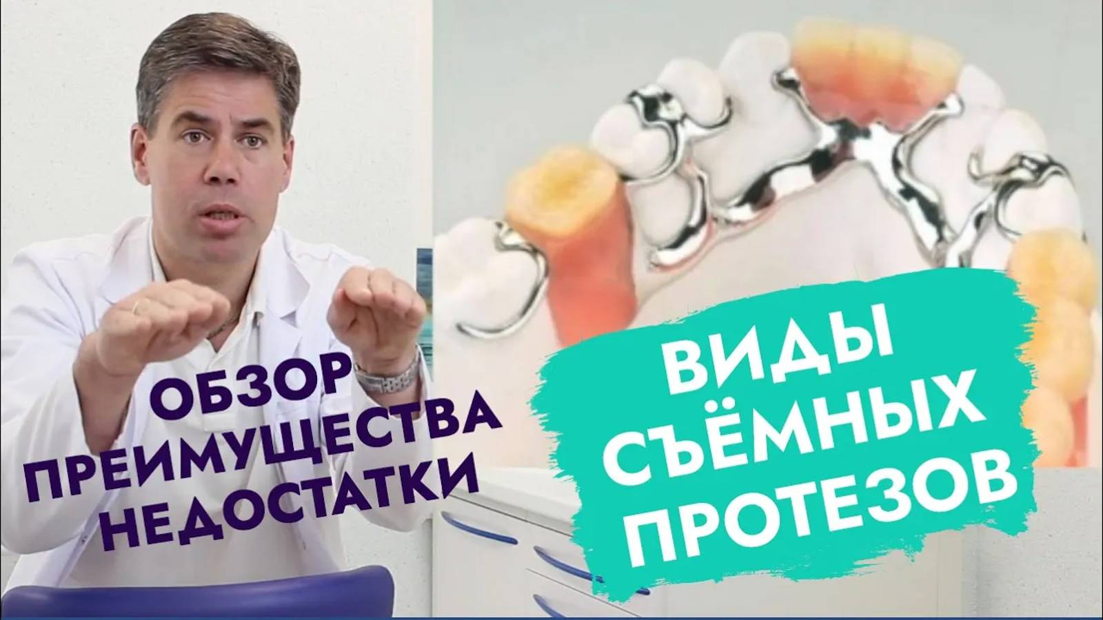 Виды съемных зубных протезов и их эффективность для жевания.