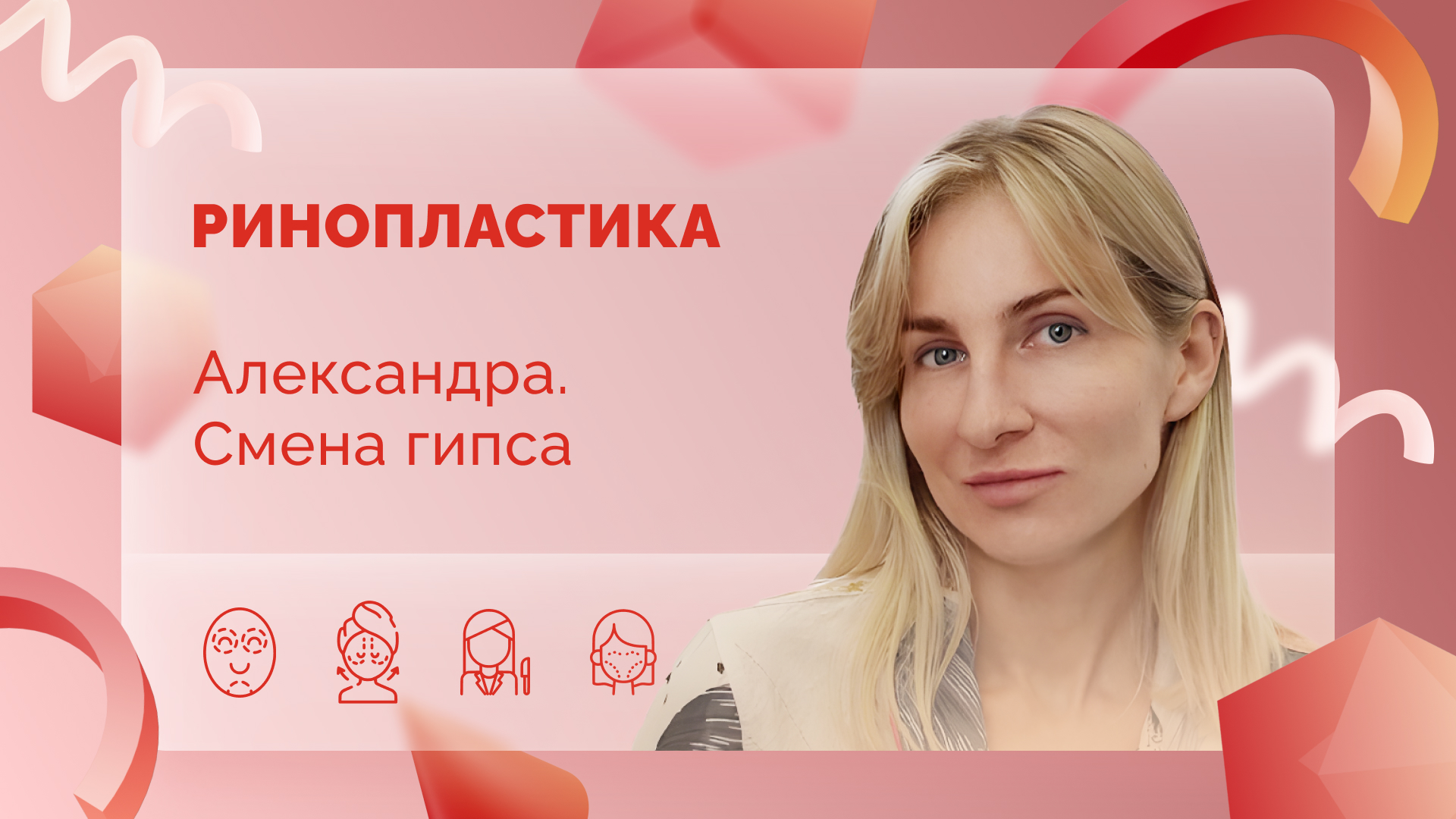 Ринопластика. Александра. Седьмые сутки после операции