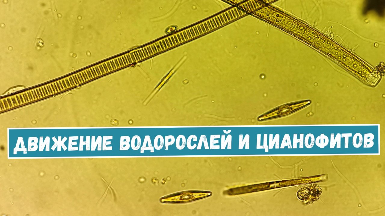 Что можно увидеть в капле воды из городского пруда? Часть 2