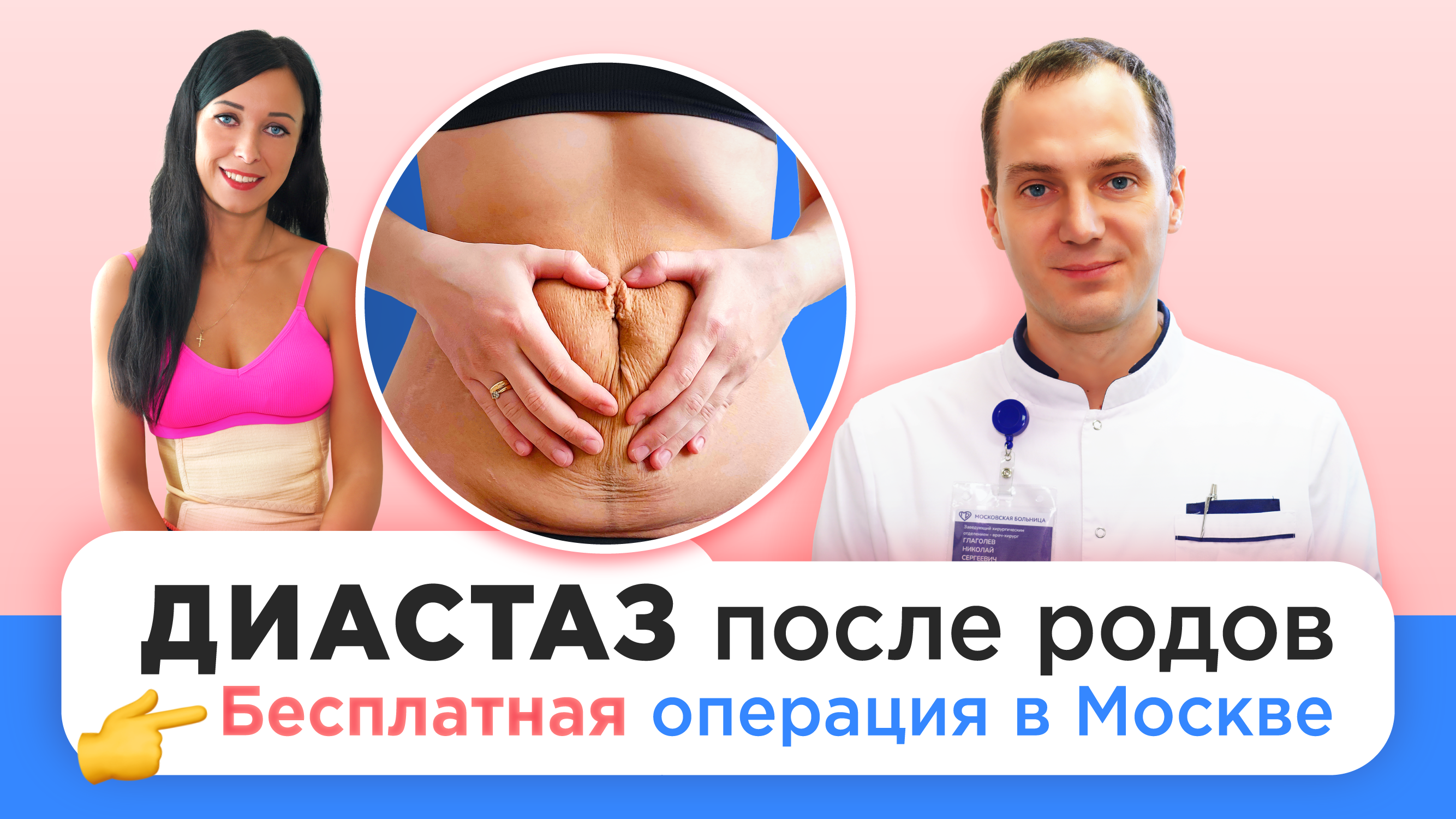 Диастаз после родов — Николай Глаголев