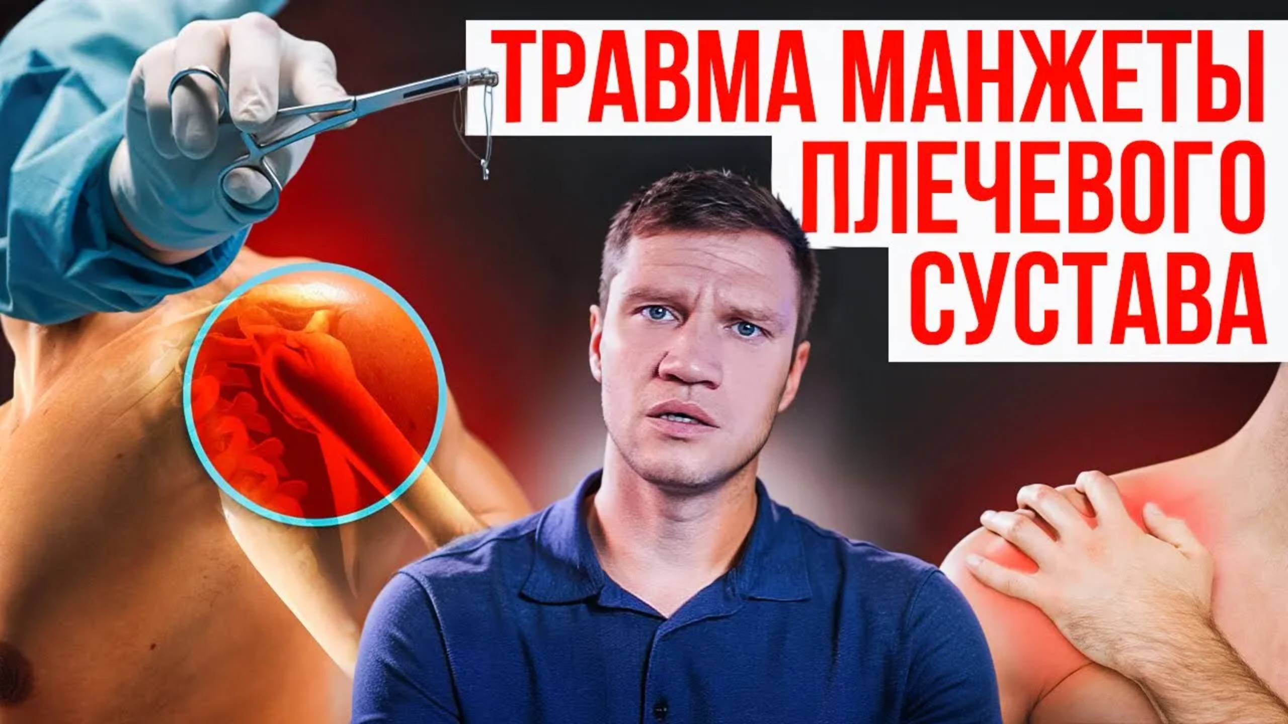 Травма манжеты плечевого сустава. Травматолог-ортопед Евгений Гончаров