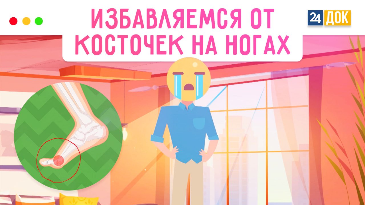 Оперируем «шишки» на ногах. МЕДСОВЕТ