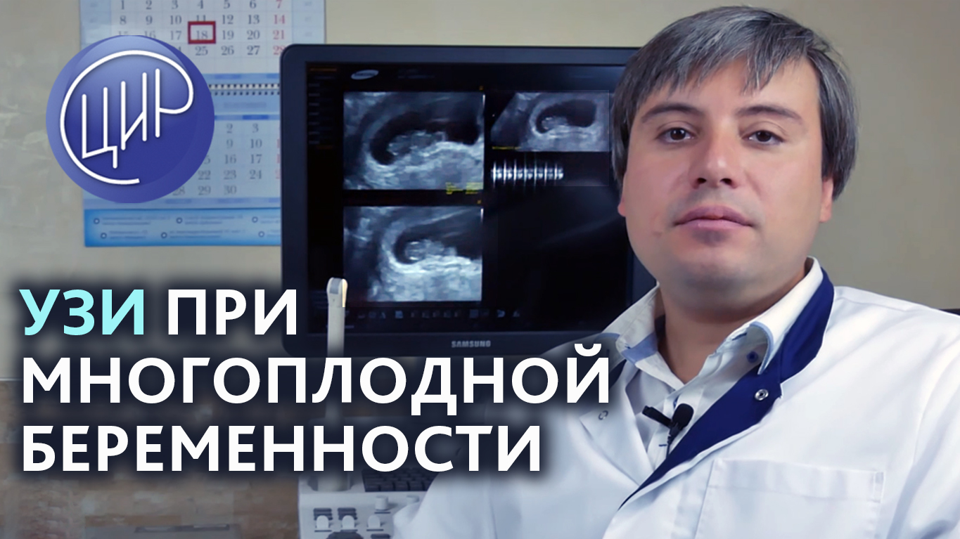 Близнецы и двойняшки на УЗИ. Ультразвуковая диагностика при многоплодной беременности.
