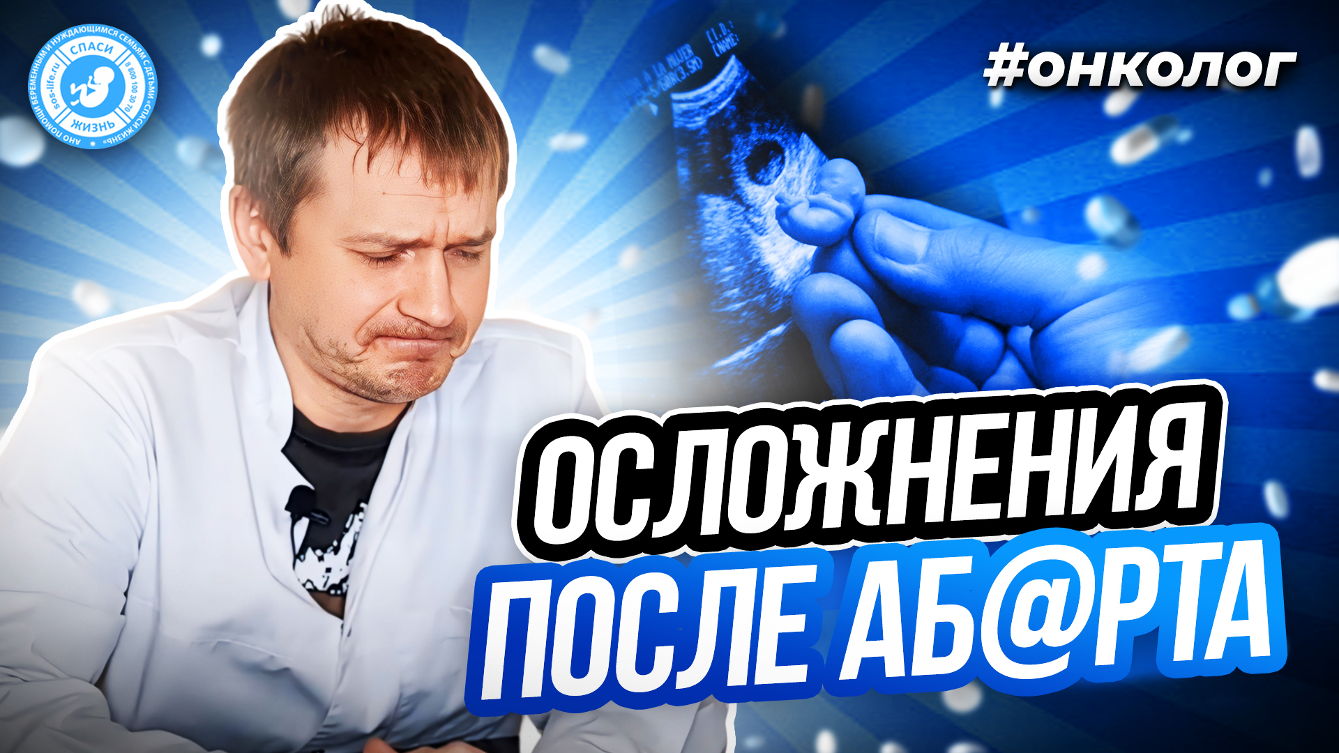 ● ОСЛOЖНEНИЯ ПОСЛЕ AБ@РТA #ОНКОЛОГ