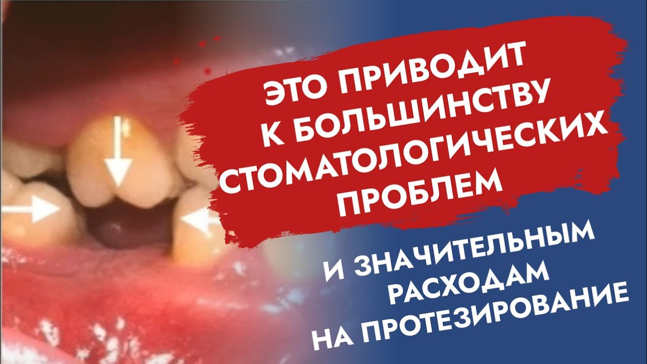 Ребенку удалили молочный или постоянный зуб.