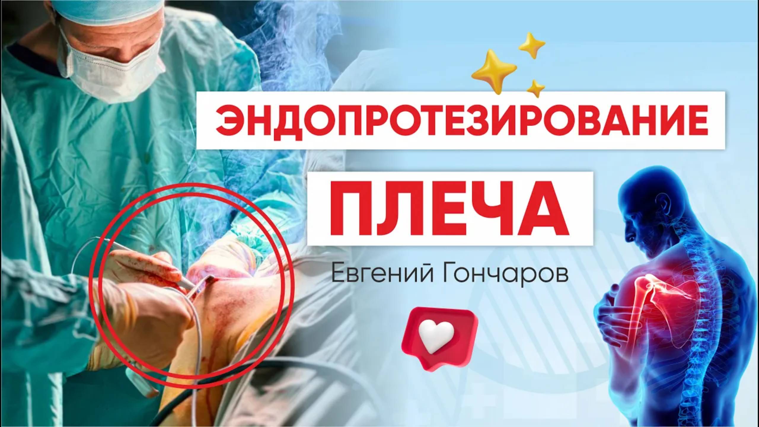 Все об эндопротезировании плеча: разбираемся с травматологом