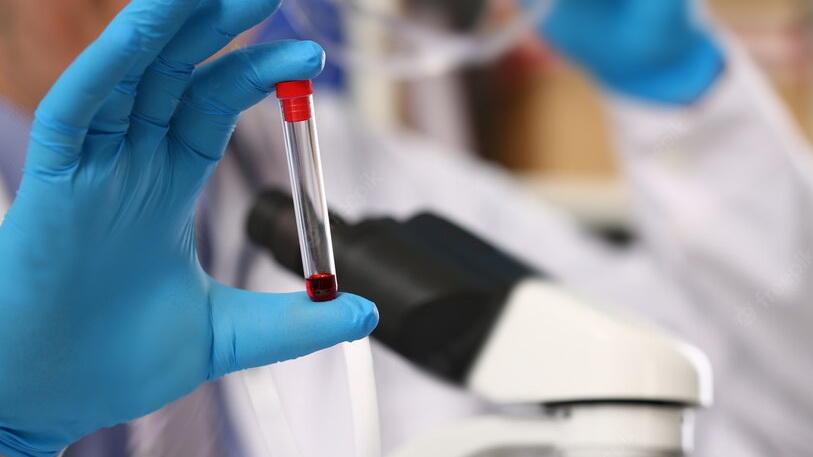 Полсотни югорчан хотят стать донорами костного мозга