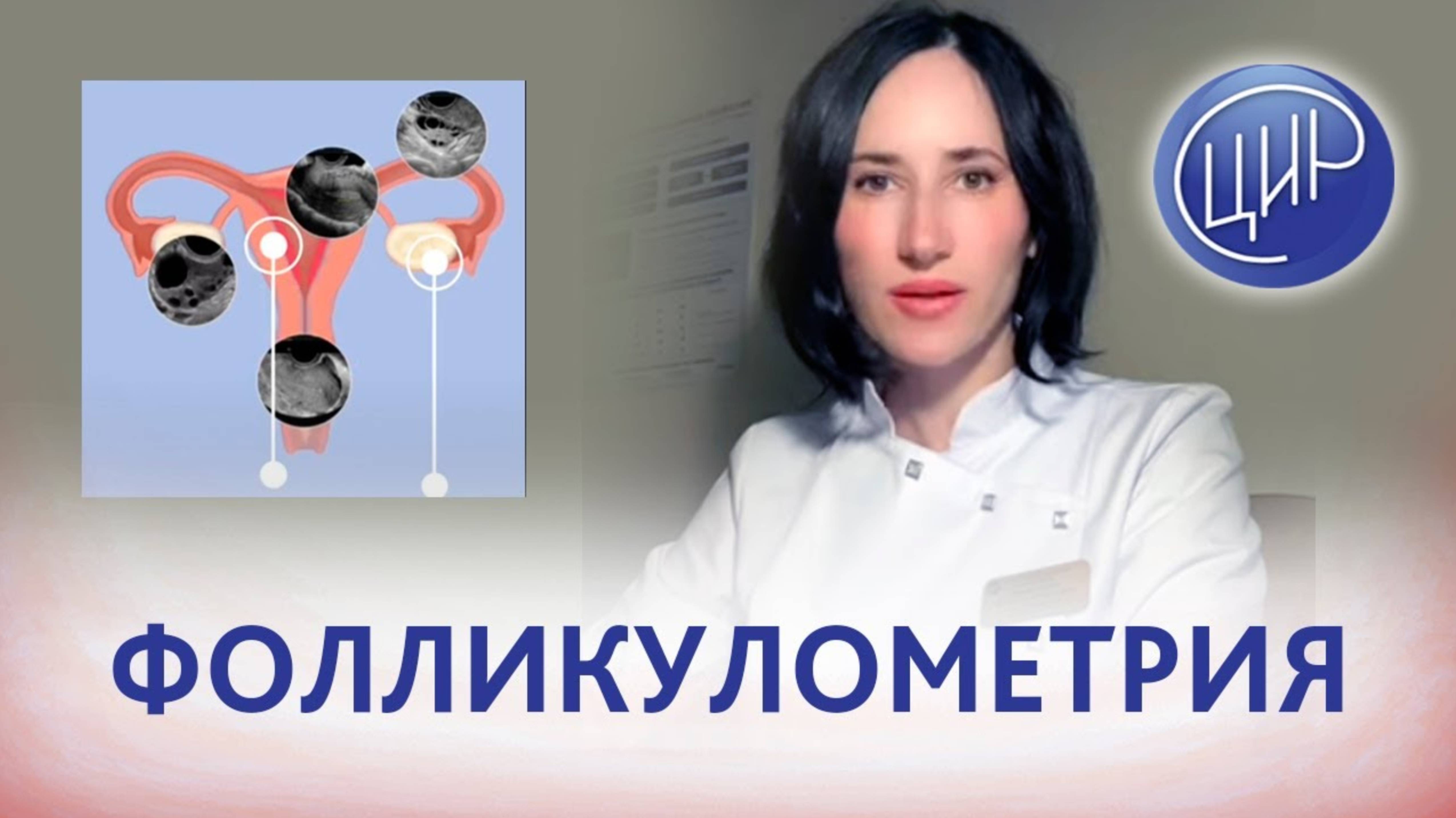 Фолликулометрия: что такое фолликулометрия и когда делается фолликулометрия. Магнитская Н.А.
