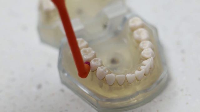 Что нужно делать чтобы не было пародонтоза? Советы стоматолога