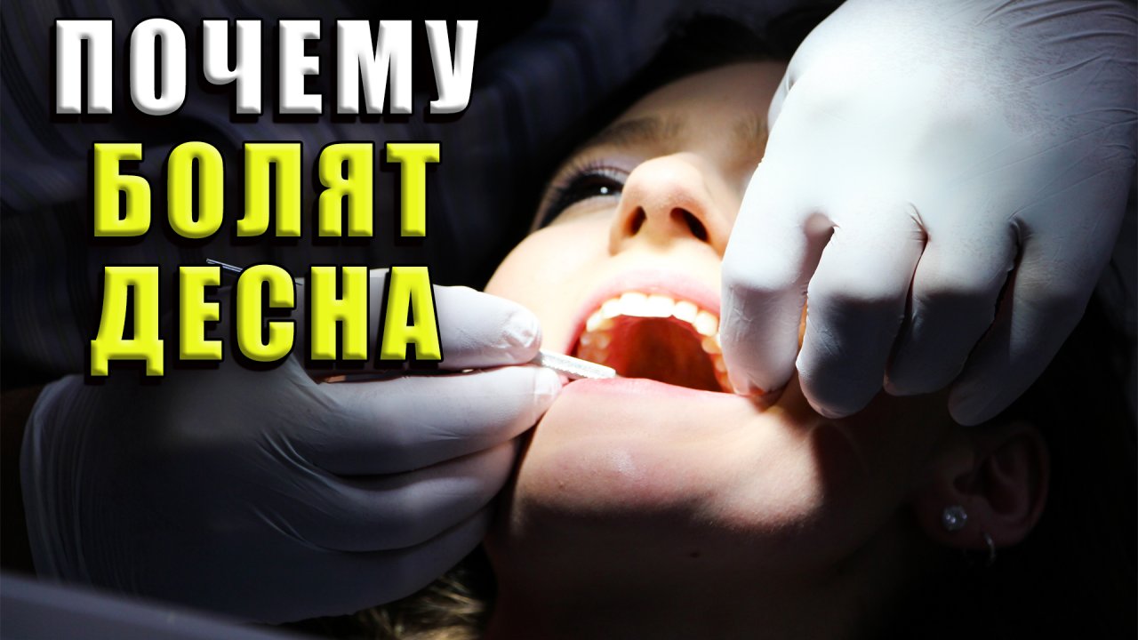 Почему болят десна