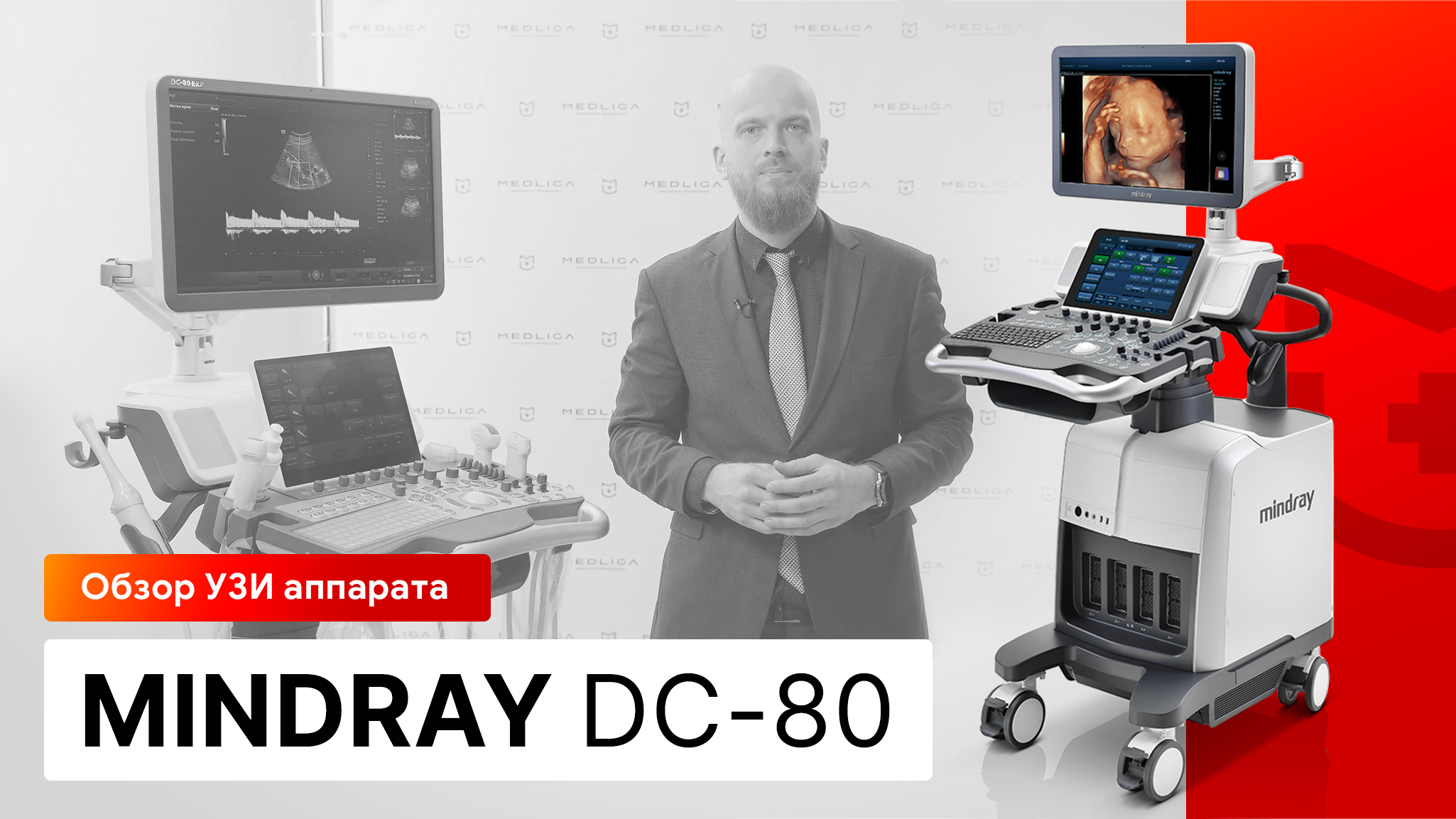 Обзор УЗИ аппарата Mindray DC-80 | Новейшие технологии в ультразвуке