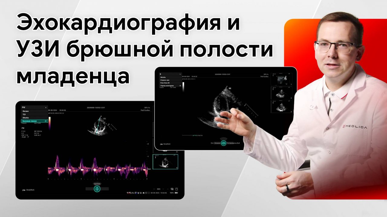 Эхокардиография и УЗИ органов брюшной полости новорожденному ребенку