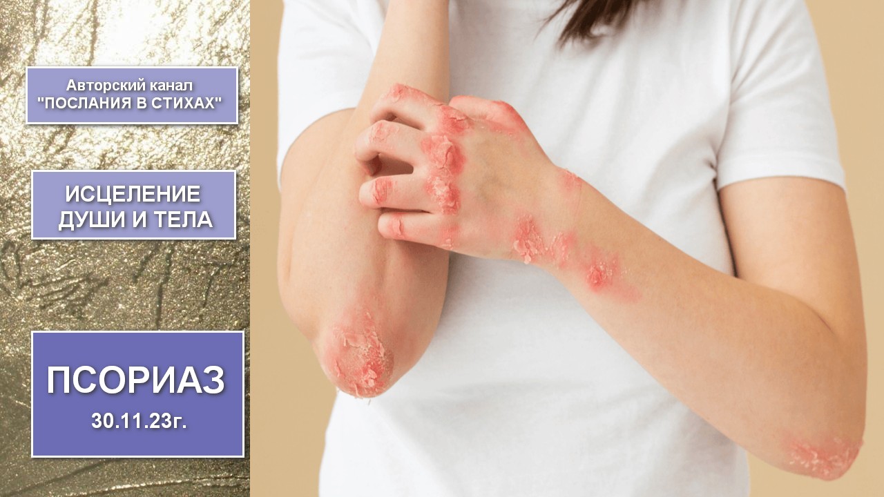 Псориаз I исцеление Души и тела