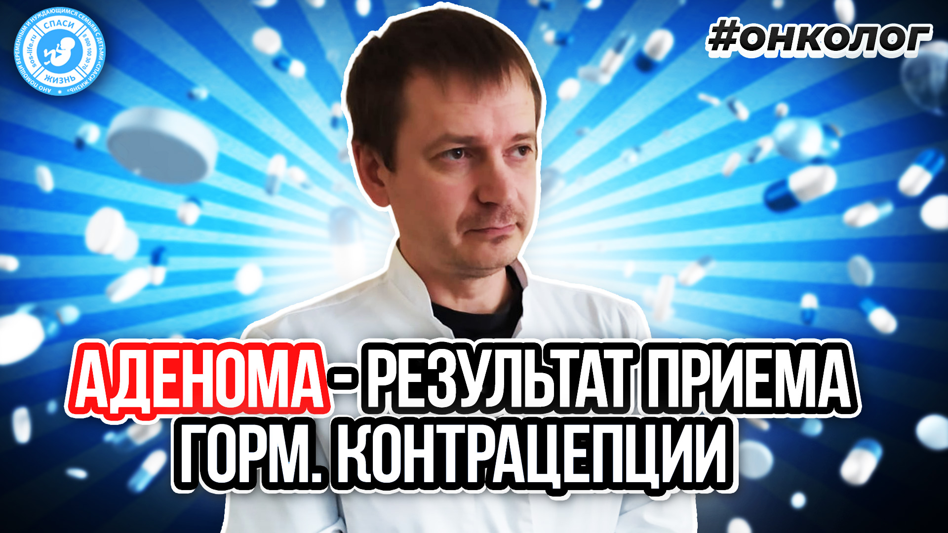 ● АДЕНОМА - РЕЗУЛЬТАТ ПРИЁМА ГОРМОНАЛЬНОЙ КОНТРАЦЕПЦИИ? #ОНКОЛОГ