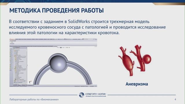 «Исследование потока в кровеносных сосудах» доцента кафедры ПМИГ СПбГЭТУ «ЛЭТИ»