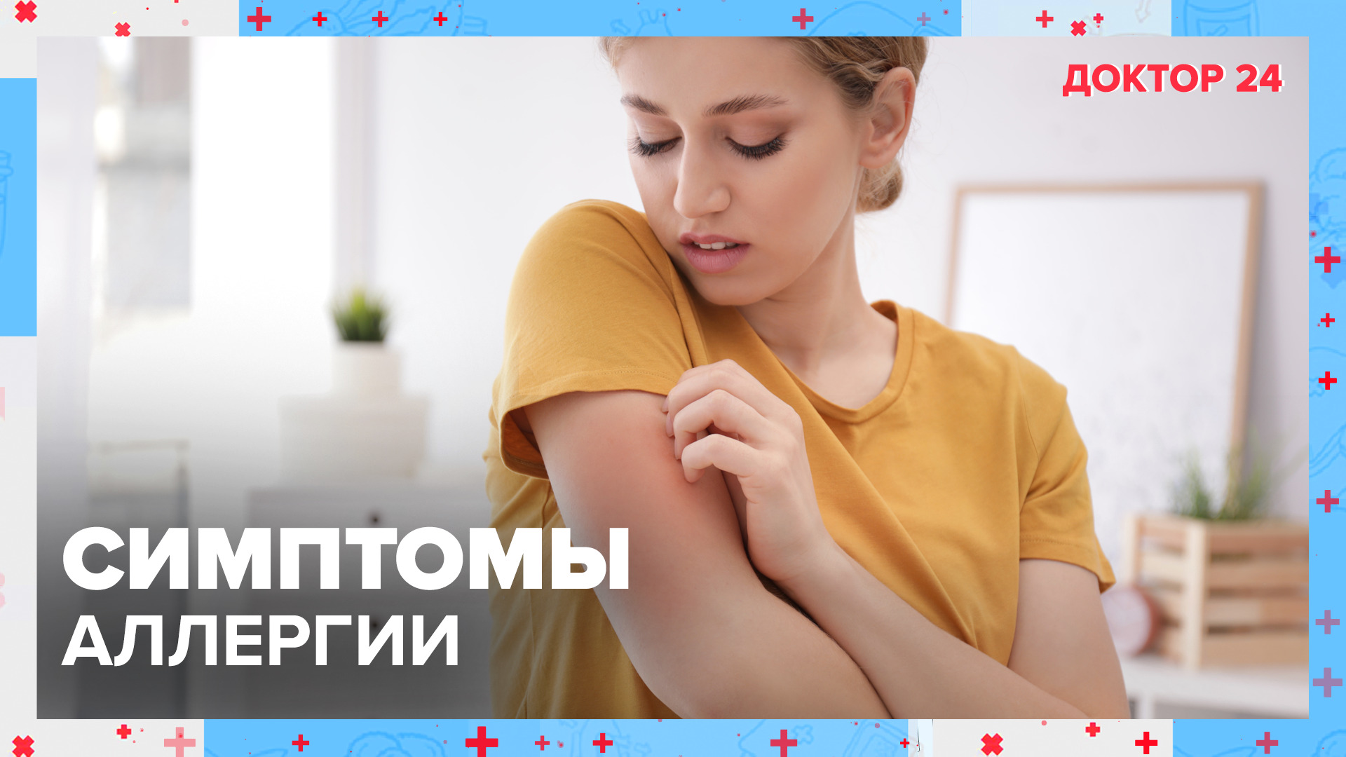 Как понять, что у вас АЛЛЕРГИЯ? | Доктор 24