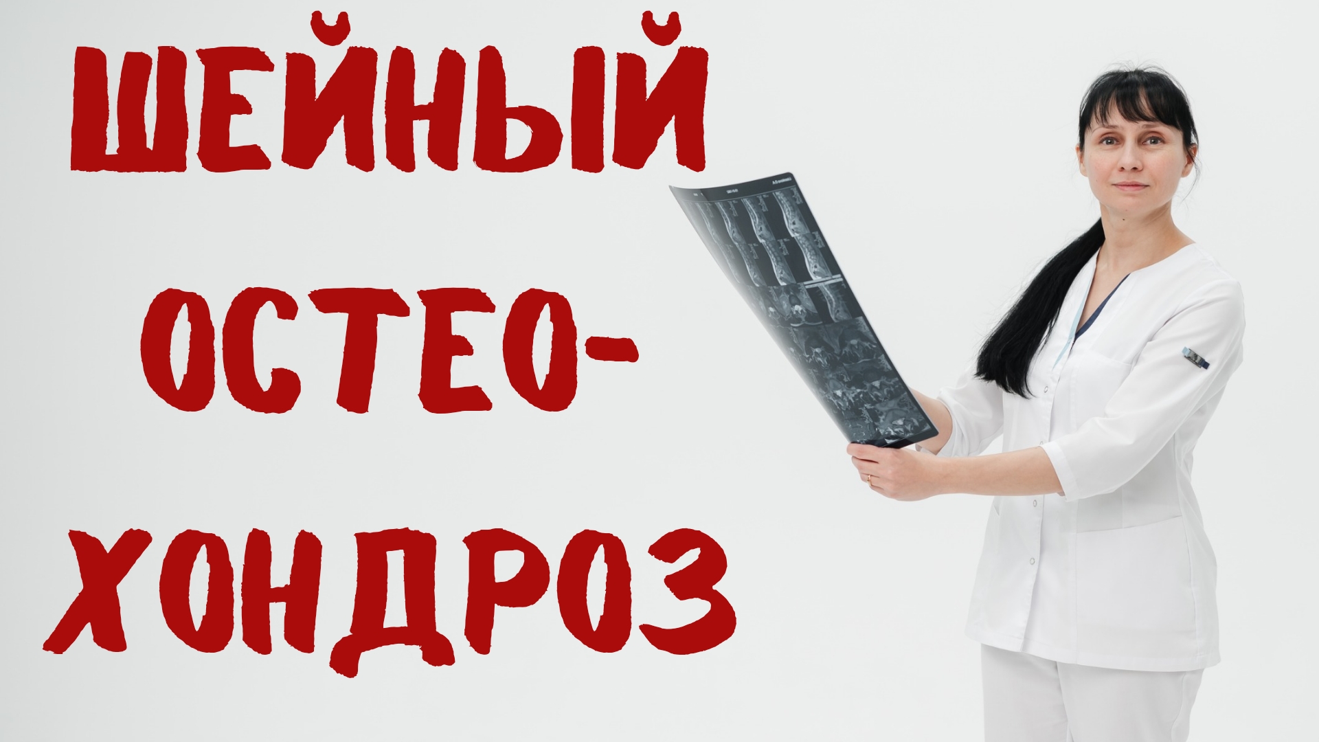 Шейный остеохондроз - норма или причина всех бед